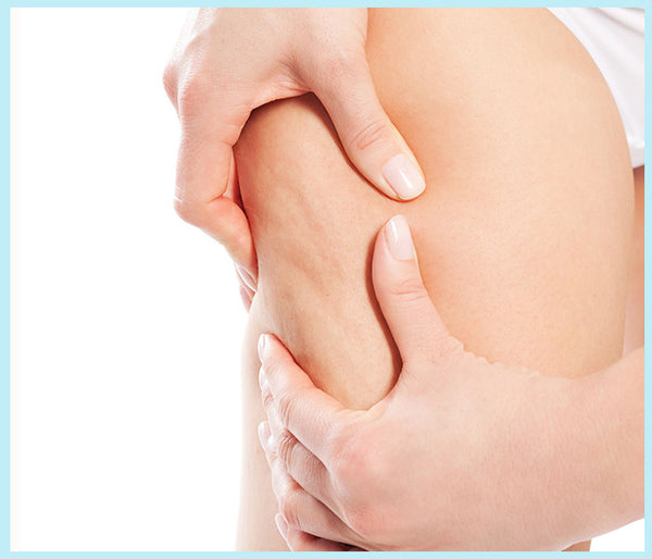 7 Interesting Facts About Cellulite You Should Be Aware Of